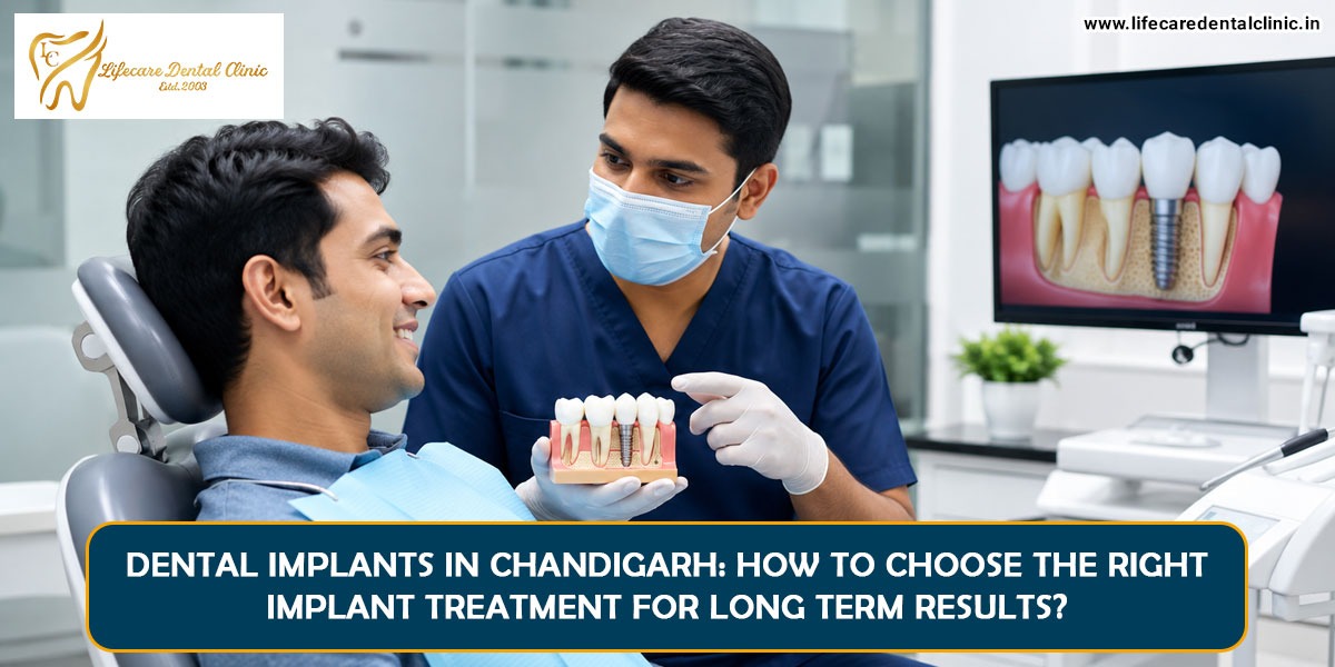 Dental-Implants-in-Chandigarh 2